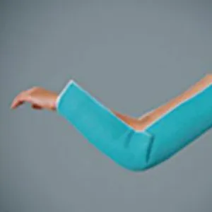 Elbow Fixation